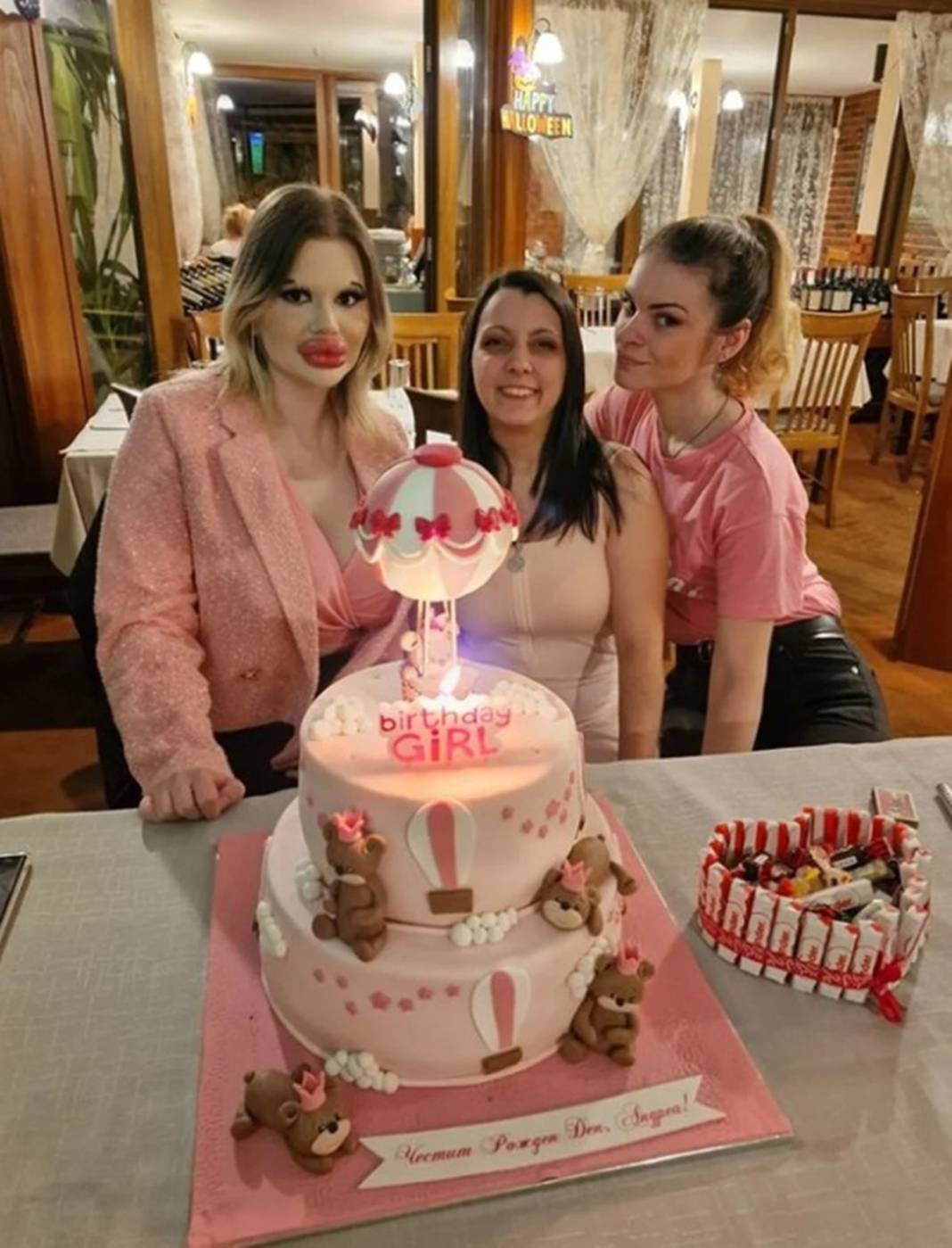 Dudak estetiğine harcadığı para 'dudak' uçuklattı 5